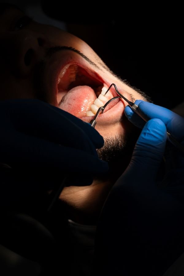 Oral Surgery