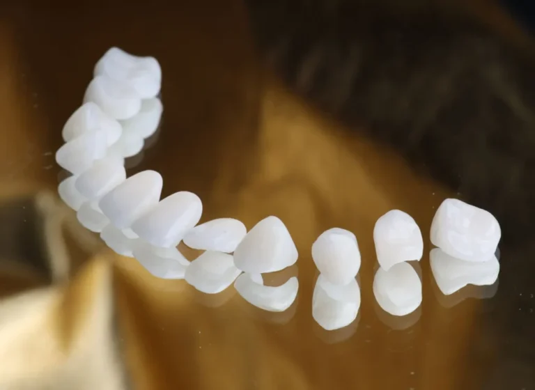 dental-veneers-dubai-1-1024x747